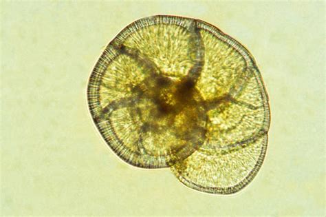  Foraminifera: Exploring the Microscopic World of Shell-Building Protozoans!