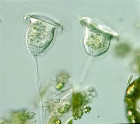  Vorticella! Bir Gizemli Dansçı: Sessiz Su Dünyasında Döndürücü Bir Hayatı Keşfedin