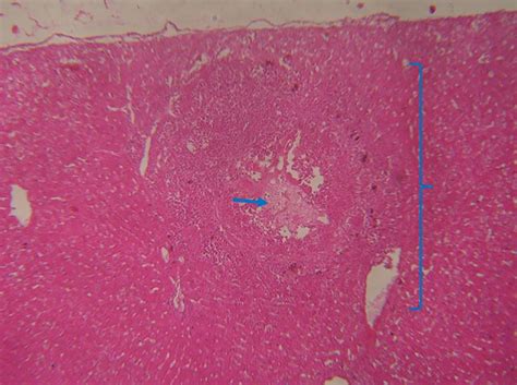  Hepatocystis! A Microscopic Parasite Capable of Both Lurking in Silence and Triggering Dramatic Liver Transformations